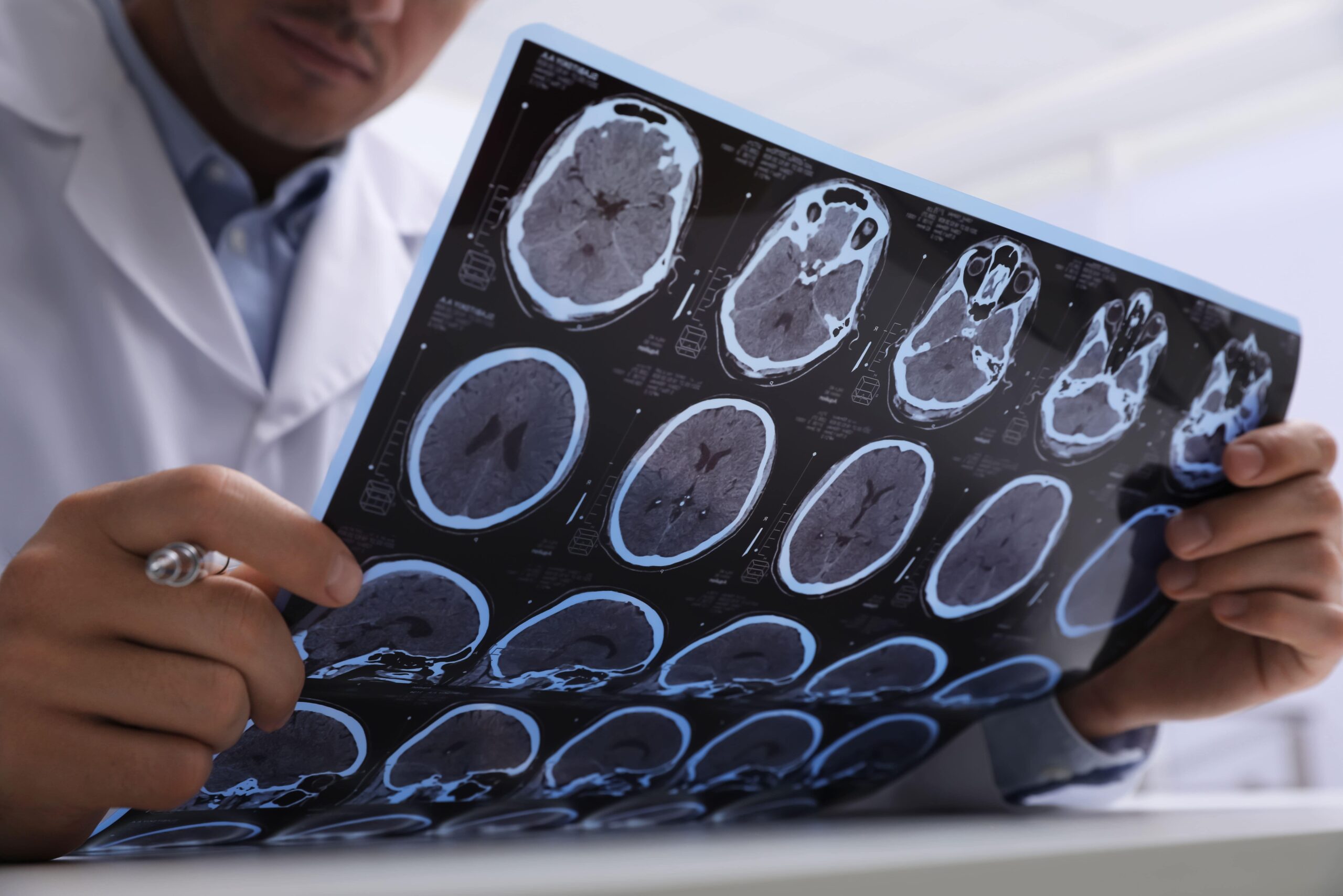 How Severe Are Brain Injuries?